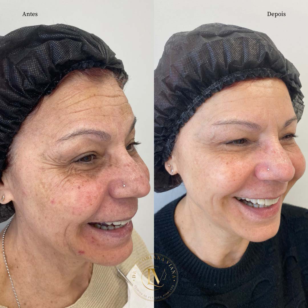 harmonizacao-facial-em-sao-paulo-1